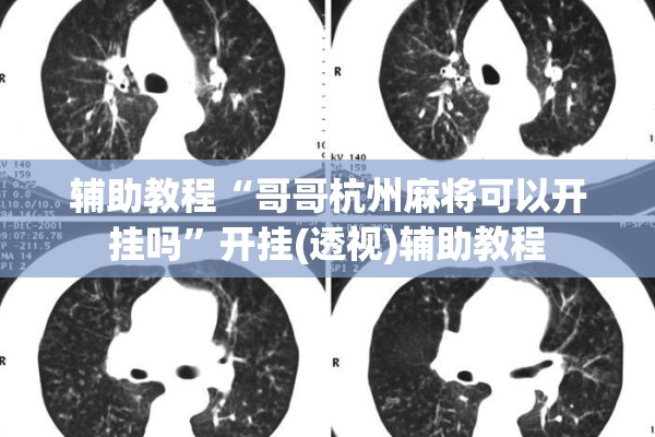 辅助教程“哥哥杭州麻将可以开挂吗	”开挂(透视)辅助教程