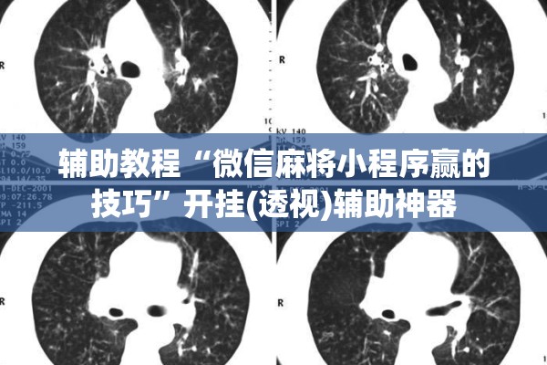 辅助教程“微信麻将小程序赢的技巧”开挂(透视)辅助神器