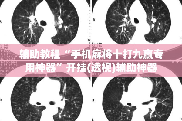 辅助教程“手机麻将十打九赢专用神器	”开挂(透视)辅助神器