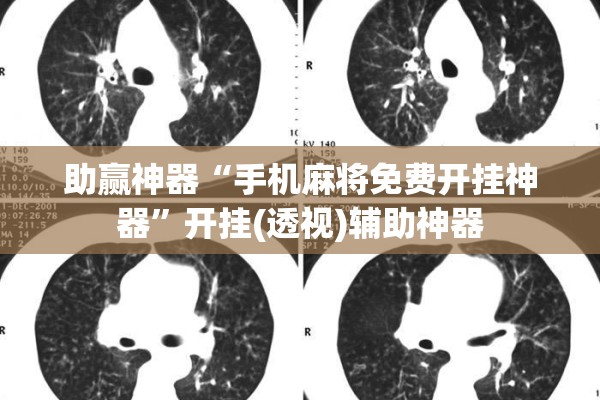 助赢神器“手机麻将免费开挂神器”开挂(透视)辅助神器